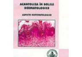 Acantoliza in bolile dermatologice - Mariana Costache, Daniela Ciochina