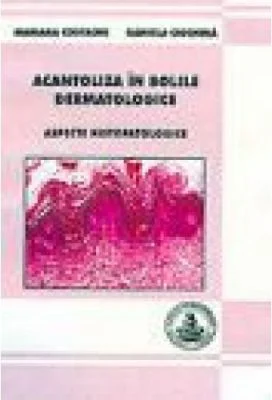 Acantoliza in bolile dermatologice - Mariana Costache, Daniela Ciochina
