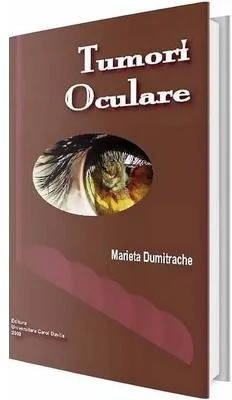 Tumori oculare - Marieta Dumitrache
