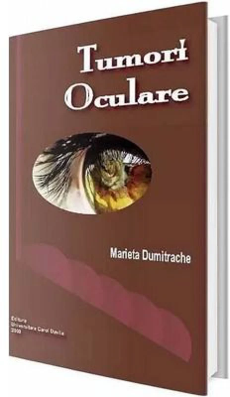 Tumori oculare - Marieta Dumitrache