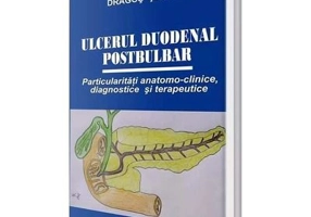Ulcerul duodenal postbulbar - Dragos Serban