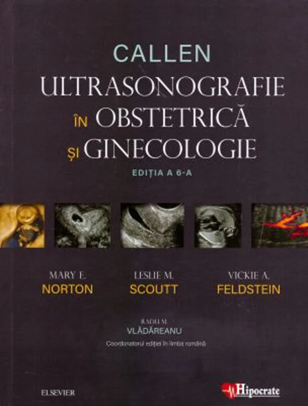 Callen. Ultrasonografie in Obstretica si Ginecologie - Mary E. Norton, Leslie M. Scoutt, Vickie A. Feldstein