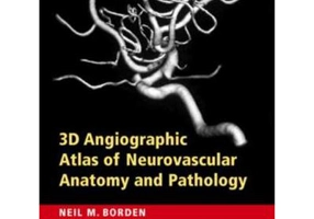 3D Angiographic Atlas of Neurovascular Anatomy and Pathology - Neil M. Borden MD