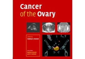 Cancer of the Ovary - Rodney Reznek