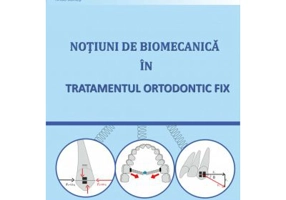 Notiuni de biomecanica in tratamentul ortodontic fix - Mariana Pacurar