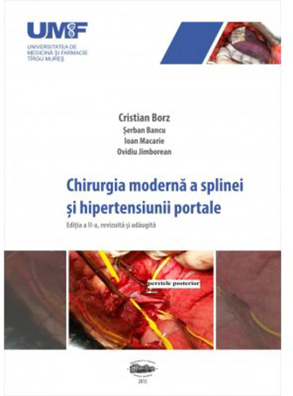 Chirurgia moderna a splinei si hipertensiunii portale - Cristian Borz, Serban Bancu, Ioan Macarie