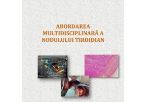 Abordarea multidisciplinara a nodulului tiroidian - Ionela Pascanu