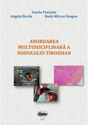 Abordarea multidisciplinara a nodulului tiroidian - Ionela Pascanu