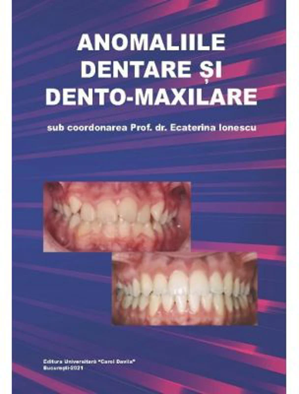 Anomaliile dentare si dento-maxilare - Ecaterina Ionescu