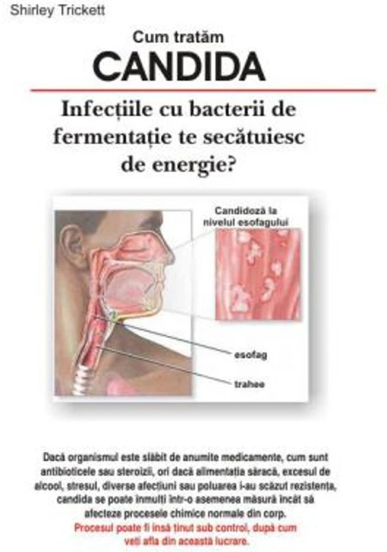 Candida - Shirley Trickett