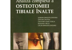 Analiza complexa a Osteotomiei Tibiale Inalte