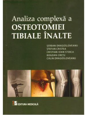Analiza complexa a Osteotomiei Tibiale Inalte