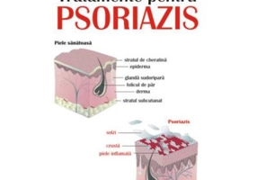 Tratamente pentru psoriazis - Prof. dr. Ronald Marks