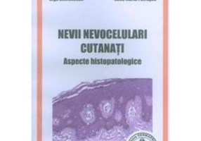 Nevii nevocelulari cutanati. Aspecte histopatologice - Mariana Costache