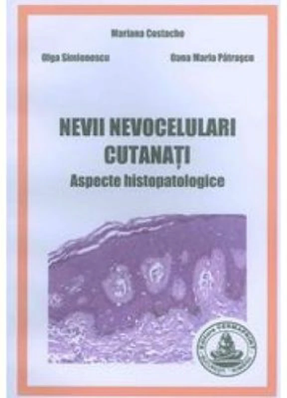 Nevii nevocelulari cutanati. Aspecte histopatologice - Mariana Costache