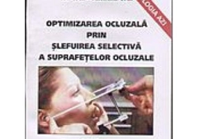 Optimizarea ocluzala prin slefuire selectiva a suprafetelor ocluzale - Ion Coca