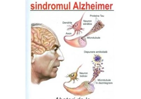 A trai cu sindromul Alzheimer - Tom Smith