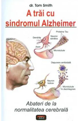 A trai cu sindromul Alzheimer - Tom Smith