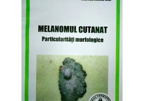 Melanomul cutanat. Particularitati morfologice - Mariana Costache