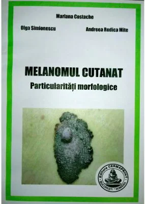 Melanomul cutanat. Particularitati morfologice - Mariana Costache