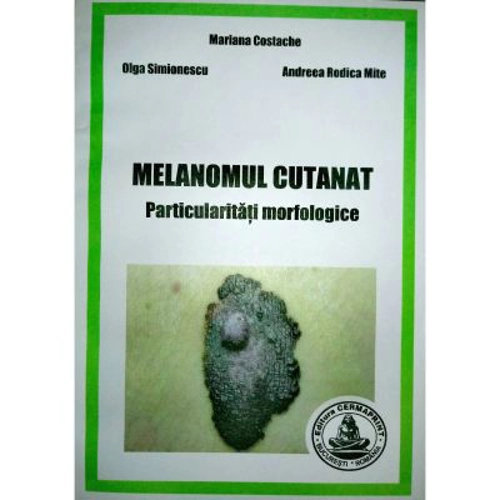 Melanomul cutanat. Particularitati morfologice - Mariana Costache