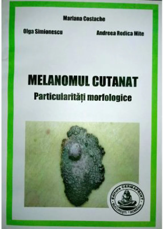 Melanomul cutanat. Particularitati morfologice - Mariana Costache