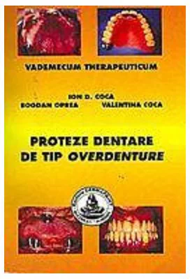 Proteze dentare de tip overdenture - Ion Coca