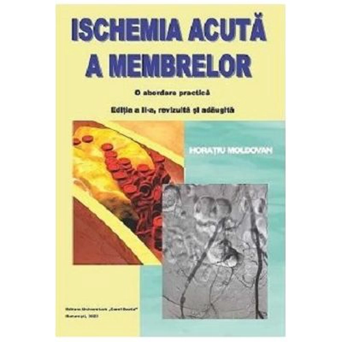 Ischemia acuta a membrelor. O abordare practica