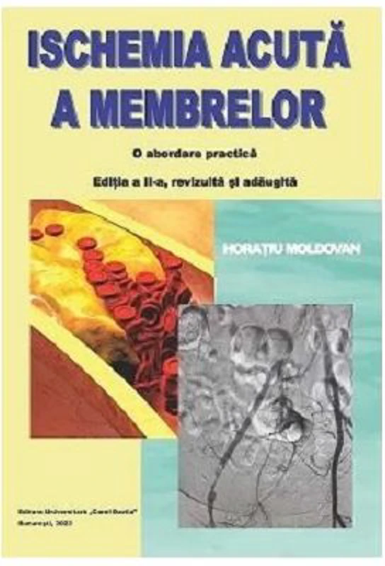 Ischemia acuta a membrelor. O abordare practica