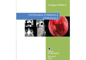 Patologia tumorala etmoidala. Strategii actuale in diagnostic si tratament - Cristina Stoica