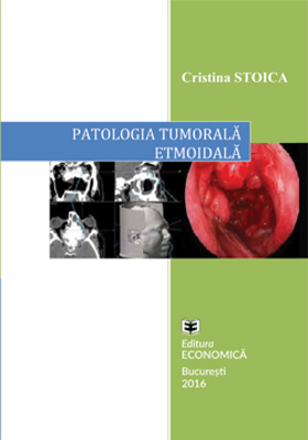 Patologia tumorala etmoidala. Strategii actuale in diagnostic si tratament - Cristina Stoica