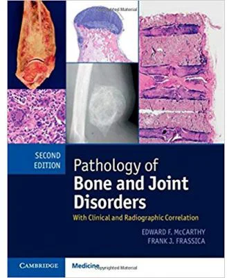 Pathology of Bone and Joint Disorders Print and Online Bundle: With Clinical and Radiographic Correlation - Edward F. McCarthy
