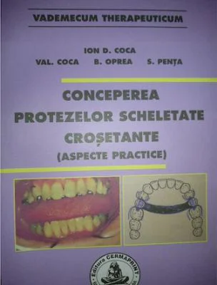 Conceperea protezelor scheletate crosetante - Ion Coca