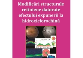 Modificari structurale retiniene datorate efectului expunerii la hidroxiclorochina - Aida Geamanu