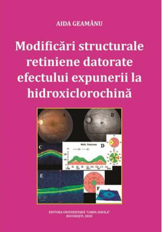 Modificari structurale retiniene datorate efectului expunerii la hidroxiclorochina - Aida Geamanu