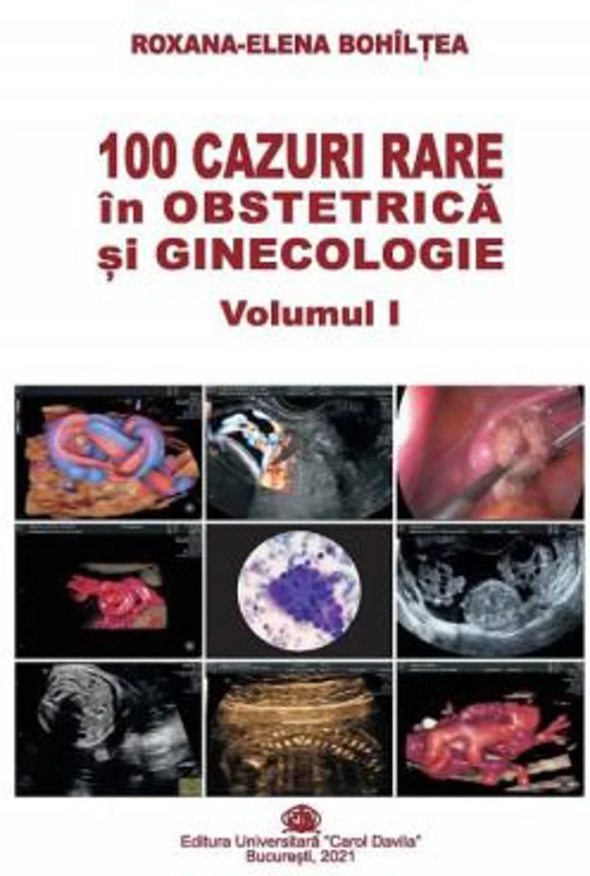 100 cazuri rare in obstetrica si ginecologie, volumul 1 - Roxana-Elena Bohiltea