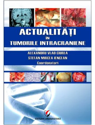 Actualitati in tumorile intracraniene - Prof. Dr. MSc. Alexandru Vlad Ciurea