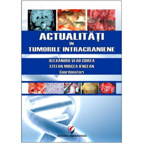 Actualitati in tumorile intracraniene - Prof. Dr. MSc. Alexandru Vlad Ciurea