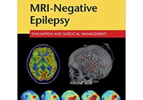 MRI-Negative Epilepsy: Evaluation and Surgical Management - Elson L. So, Philippe Ryvlin