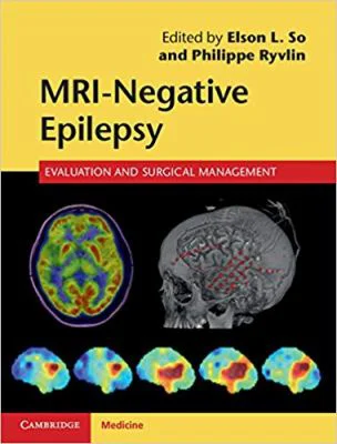 MRI-Negative Epilepsy: Evaluation and Surgical Management - Elson L. So, Philippe Ryvlin