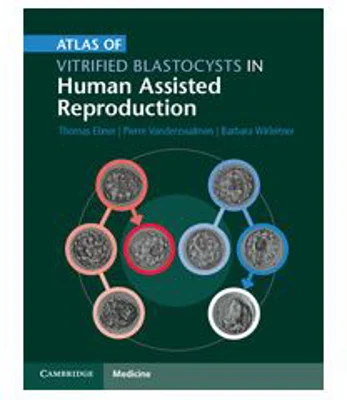 Atlas of Vitrified Blastocysts in Human Assisted Reproduction - Thomas Ebner, Pierre Vanderzwalmen, Barbara Wirleitner