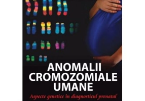 Anomalii cromozomiale umane