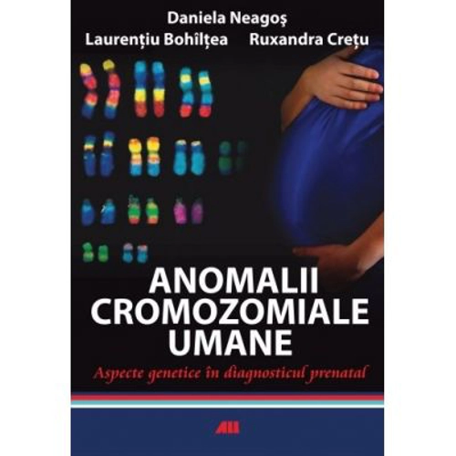 Anomalii cromozomiale umane