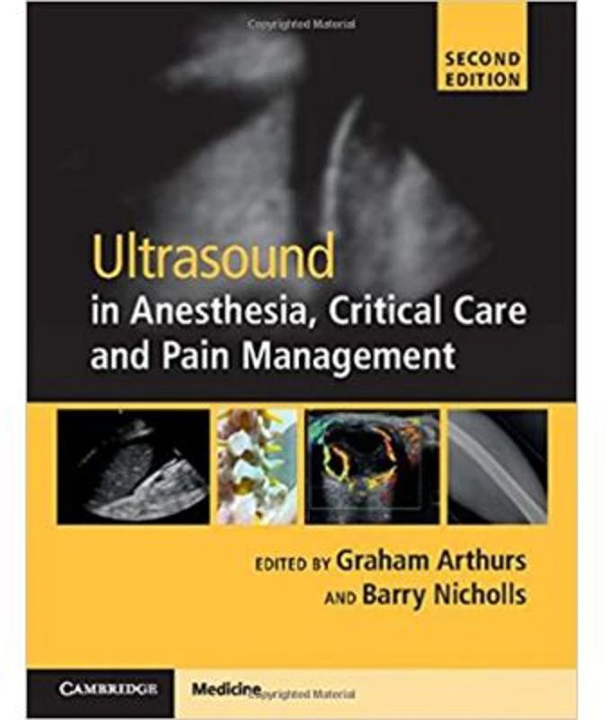 Ultrasound in Anesthesia, Critical Care and Pain Management with Online Resource - Graham Arthurs, Barry Nicholls