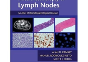 Needle Core Biopsy of Lymph Nodes with DVD-ROM: An Atlas of Hematopathological Disease - Alan D. Ramsay, Manuel Rodriguez-Justo, Scott J. Rodig