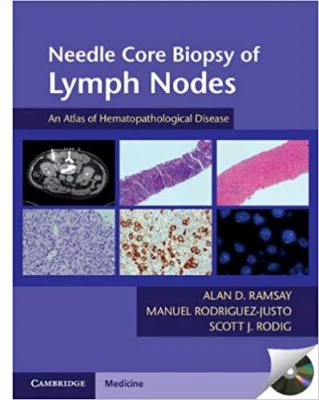 Needle Core Biopsy of Lymph Nodes with DVD-ROM: An Atlas of Hematopathological Disease - Alan D. Ramsay, Manuel Rodriguez-Justo, Scott J. Rodig
