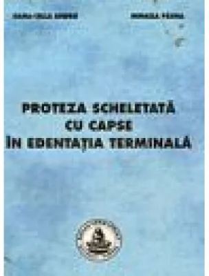 Proteza scheletata cu capse in edentatia terminala - Mihaela Pauna
