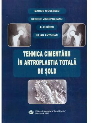 Tehnica cimentarii in artroplastia totala de sold - Marius Niculescu, George Viscopoleanu, Alin Sirbu, Iulian Antoniac