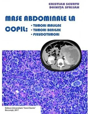 Mase abdominale la copil. Tumori maligne, tumori benigne, pseudotumori - Cristian Scurtu, Doinita Sfrijan