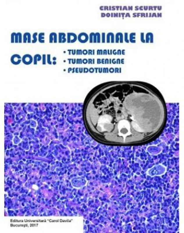 Mase abdominale la copil. Tumori maligne, tumori benigne, pseudotumori - Cristian Scurtu, Doinita Sfrijan